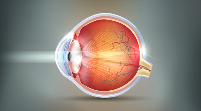 THE EYE CONDITION OF HAVING CATARACTS Cataracts abstract grey background